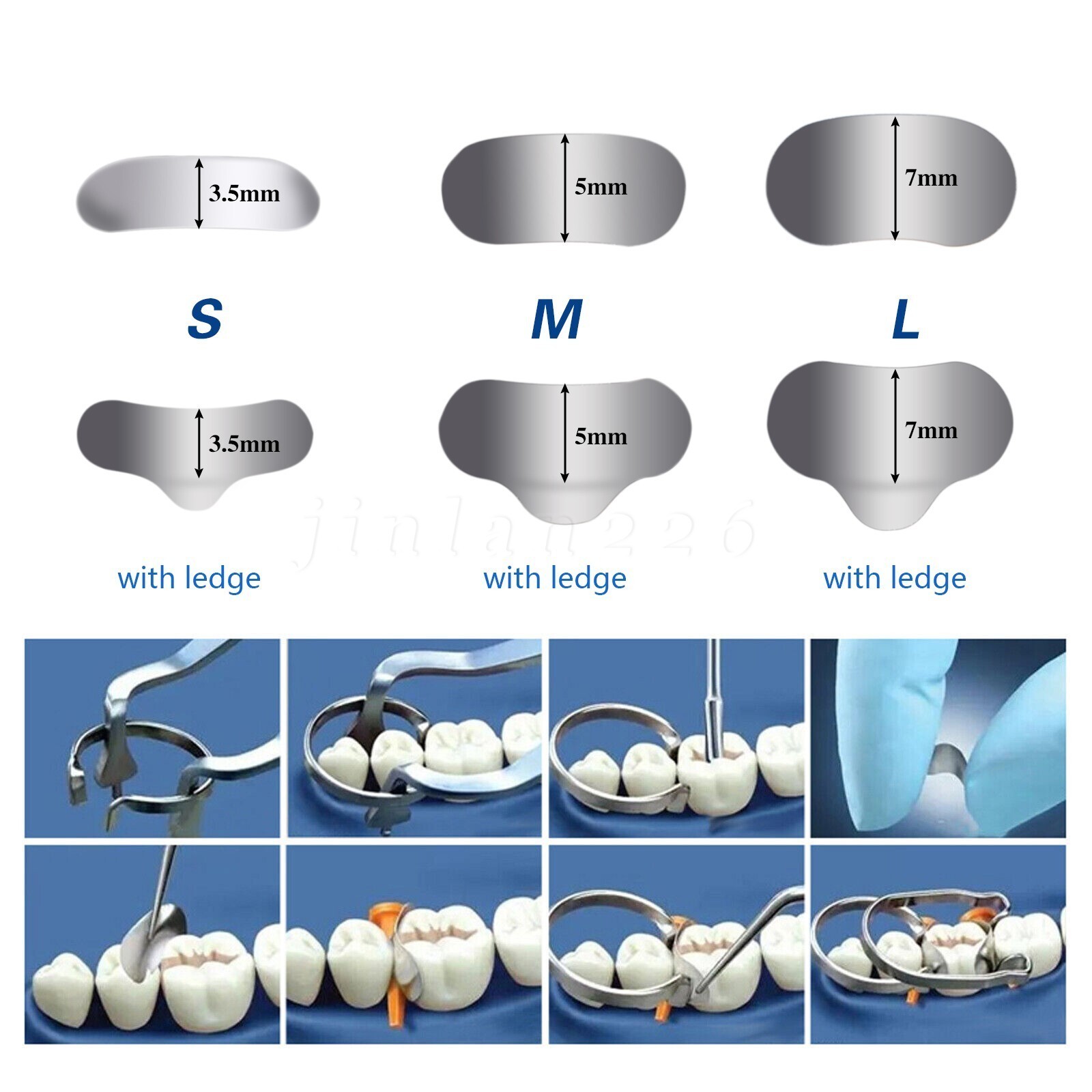 100 Pcs Dental Sectional Contoured Metal Matrices Refill Matrix Band Ledge 35um