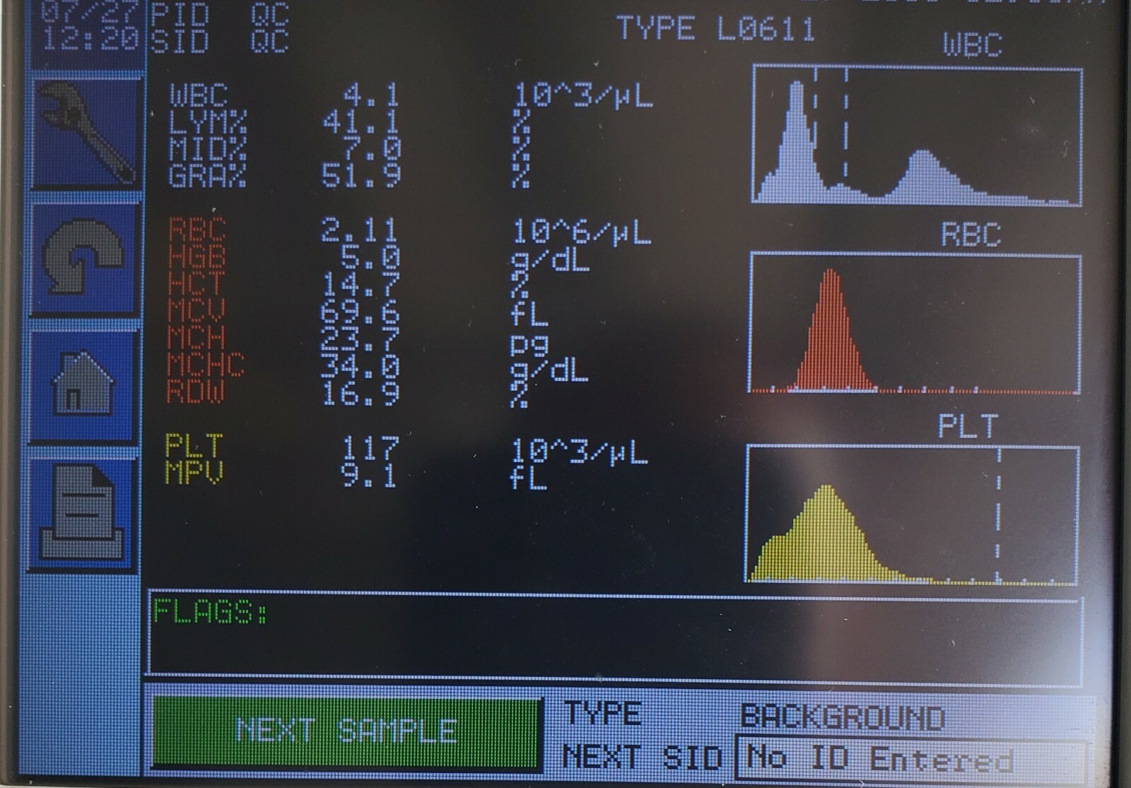 Abbott Cell-Dyn Emerald Hematology System