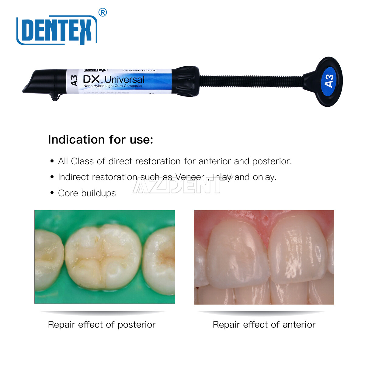 USPS DX Dental Universal Curing Light Composite Resin Shade A1 A2 A3 A3.5 B1