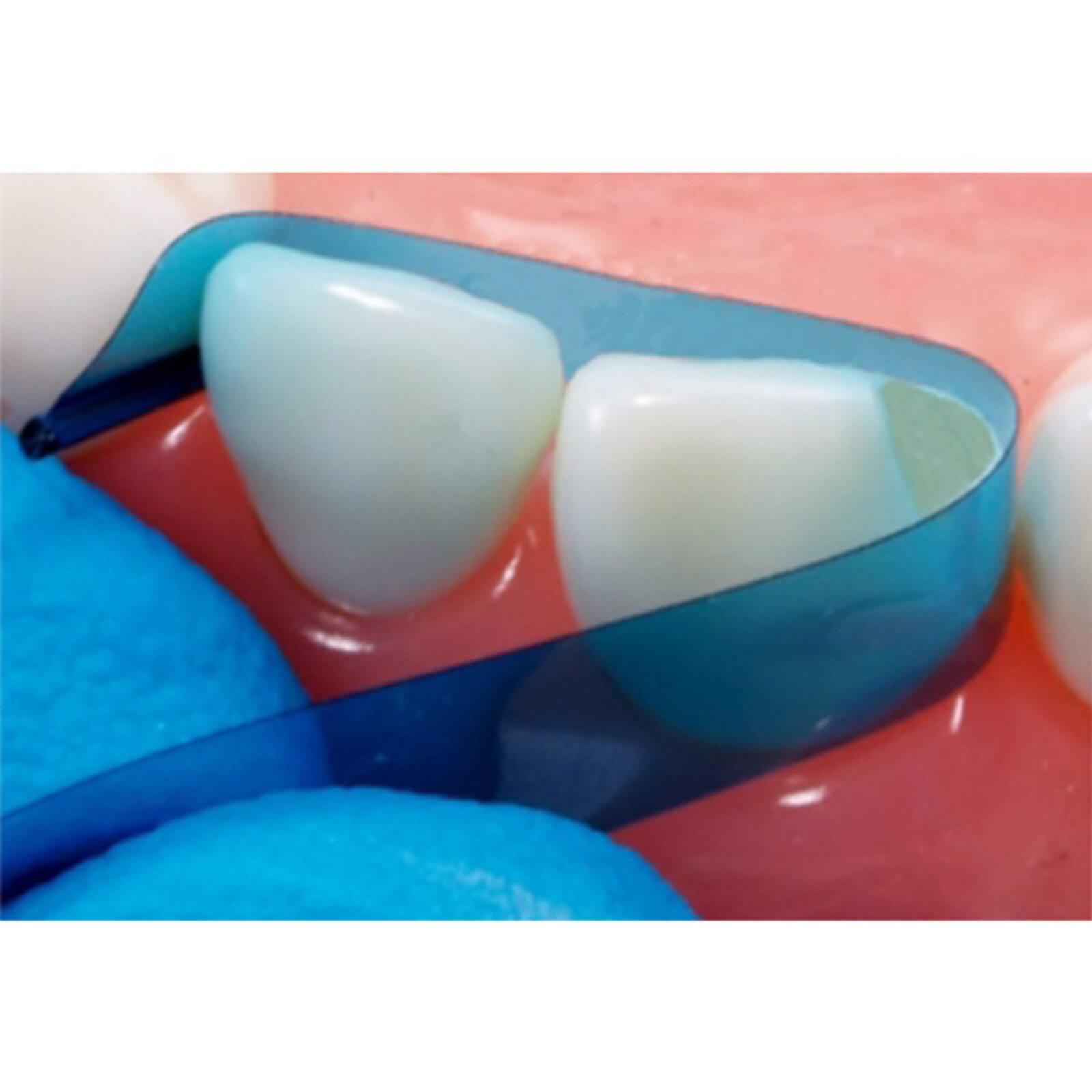 Dental Blue Strip M8 Contoured Anterior Matrix Restoration Matrices 0.05mm