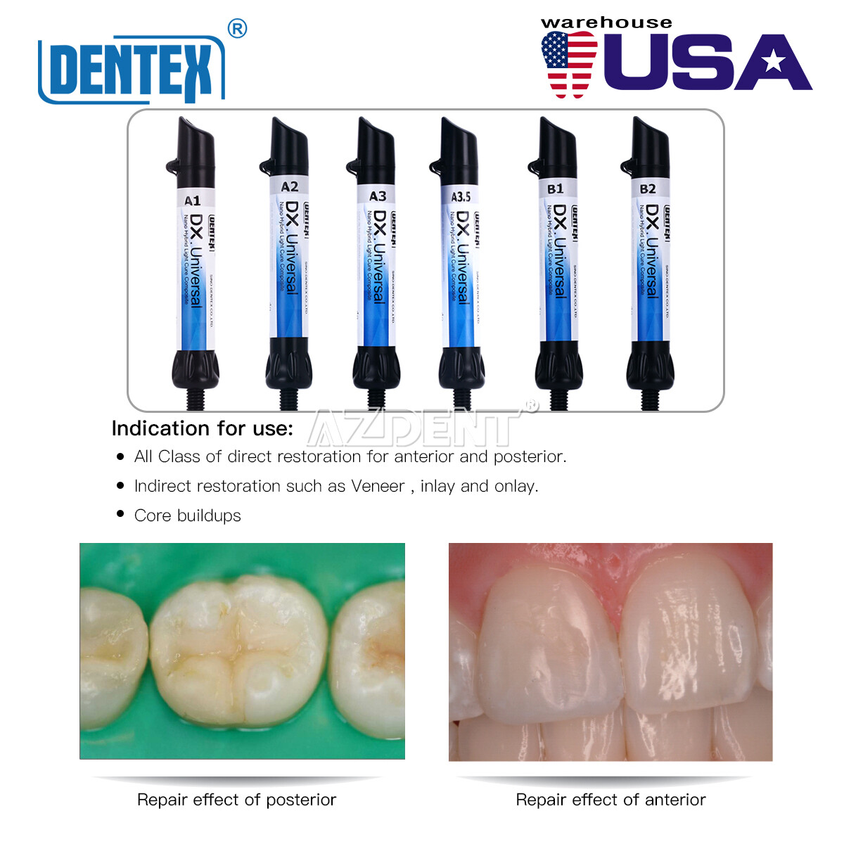 USPS DX Dental Universal Curing Light Composite Resin Shade A1 A2 A3 A3.5 B1