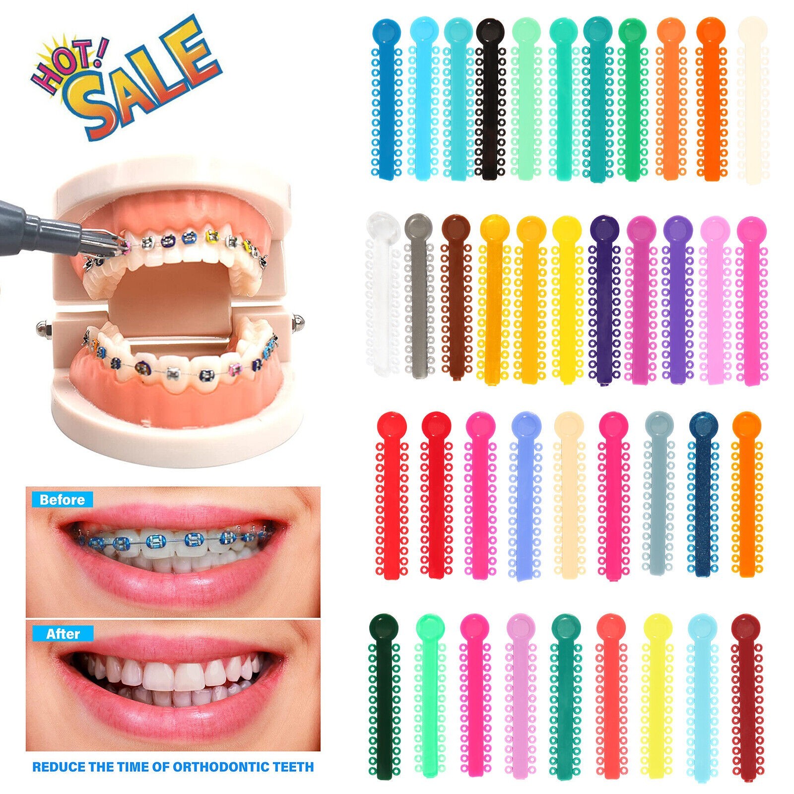 1040 Pcs Dental Orthodontic Ligature Ties Elastic Braces Rubber Bands Ligaduras