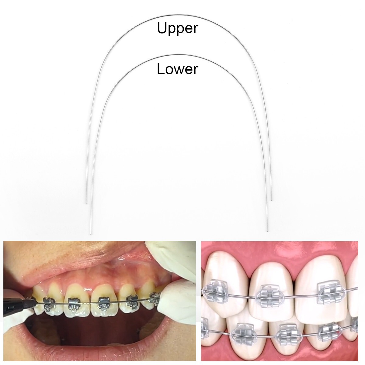 10X AZDENT Dental Orthodontic Super Elastic Niti Reverse Curve Round Arch Wires