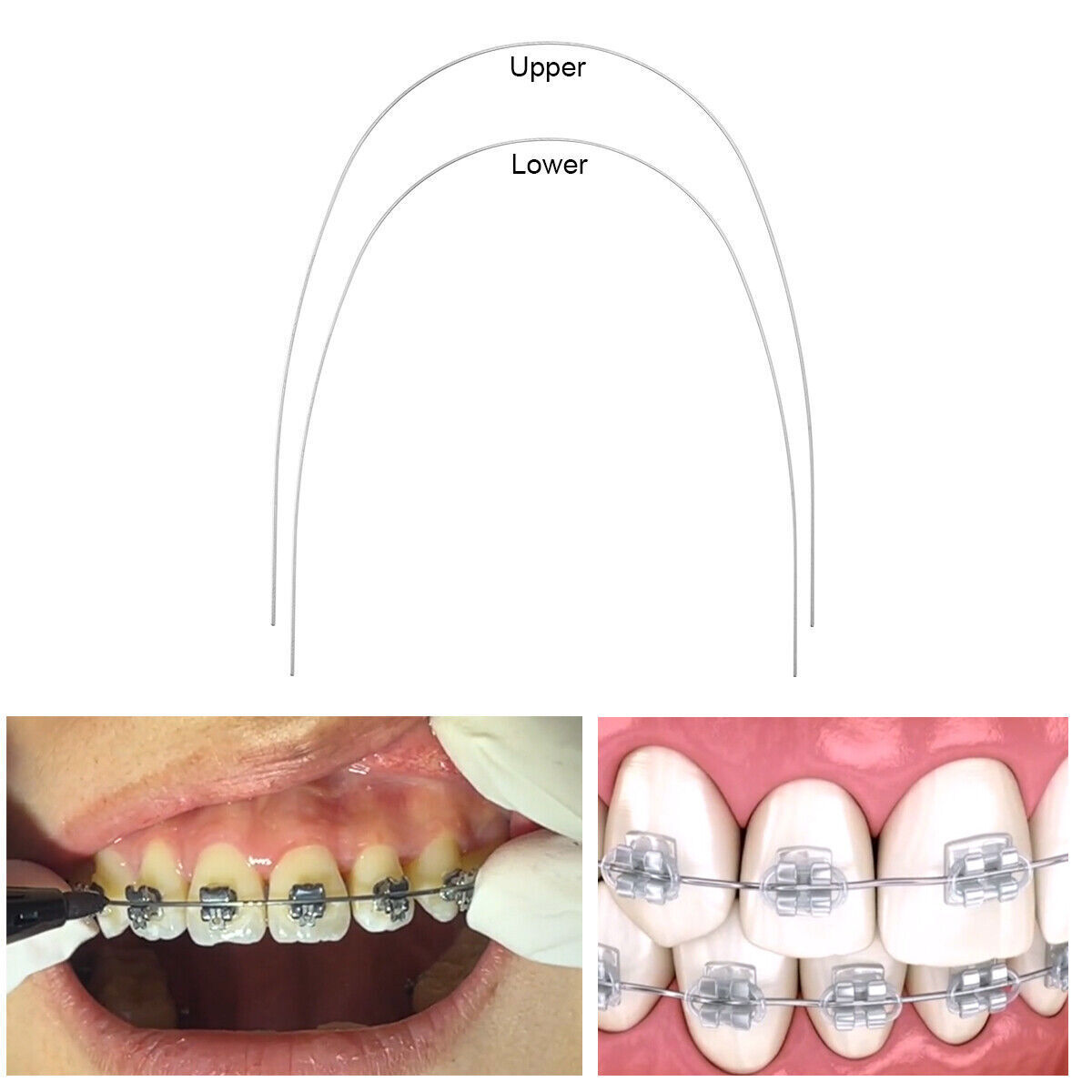 AZDENT arcos de ortodoncia niti super elástico rectángulos ovoide forma dental
