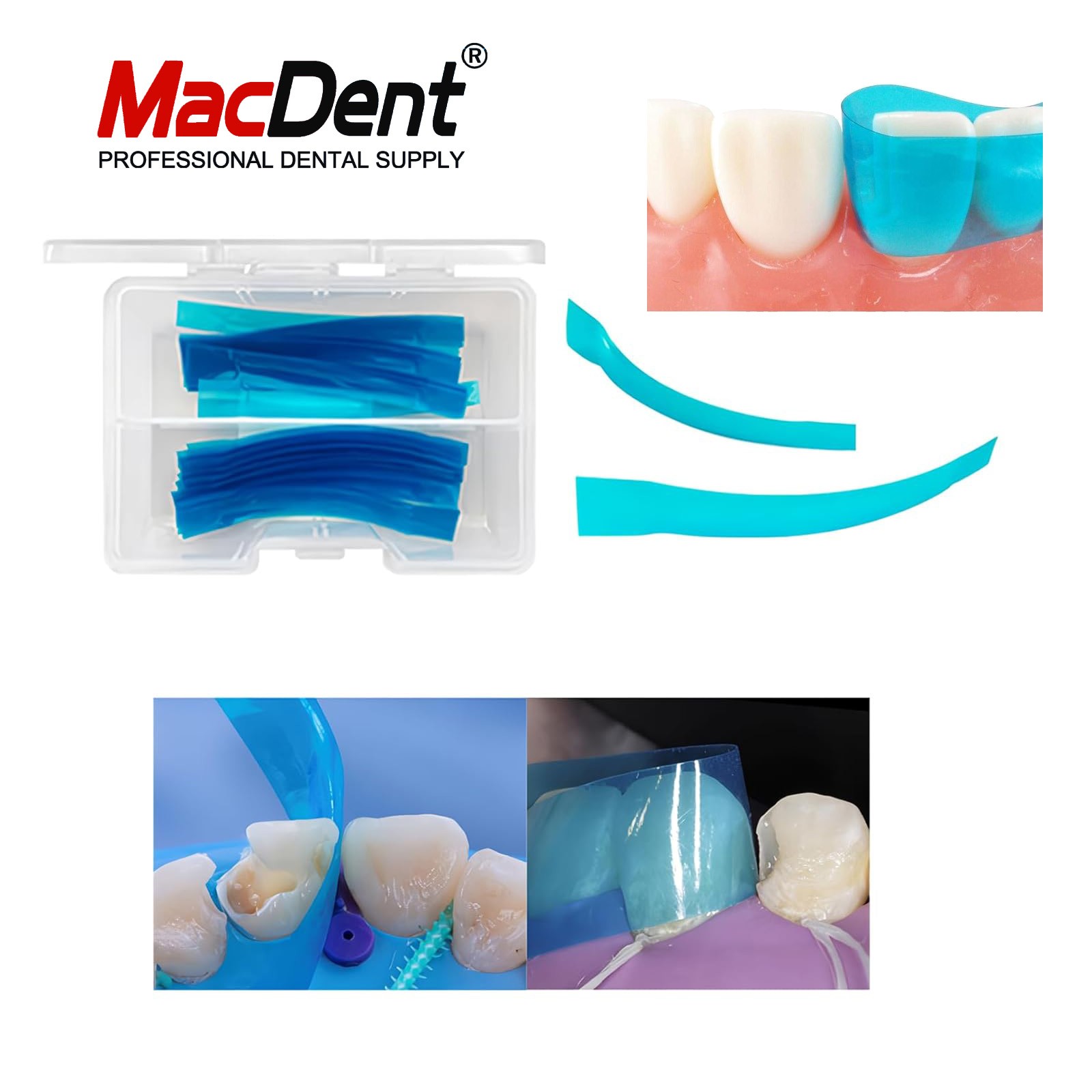 Dental Blue Strip Anterior Matrix Strips IV Composite Matrices Bands