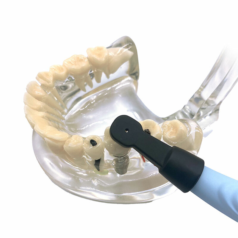 Dental Wireless Implant Sensor 3D Smart Detector Spotting 3Sensor 270℃ Rotating